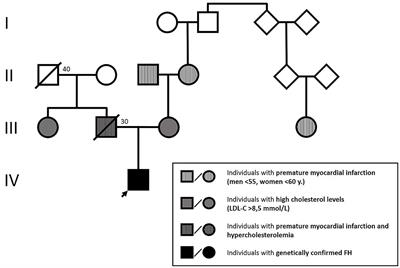 Case Report: Difficulties in the Treatment of a 12-Year-Old Patient With Homozygous Familial Hypercholesterolemia, Compound Heterozygous Form − 5 Years Follow-Up